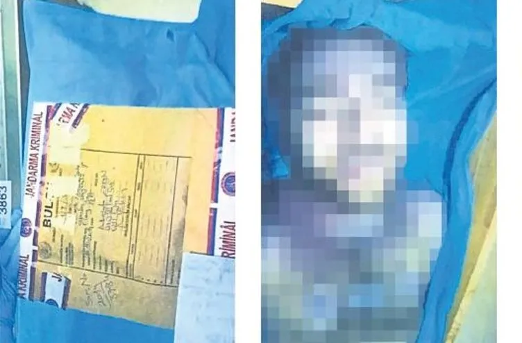 Türkiye'nin konuştuğu Cem Garipoğlu davasında flaş gelişme! SABAH otopsi fotoğraflarına ulaştı