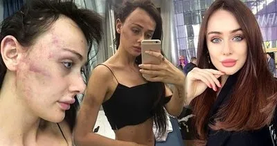 SON DAKİKA: Sırp model Tanja Dukiç darp edilmişti! Davada çok önemli gelişme... ’Psikolojisi bozuk’