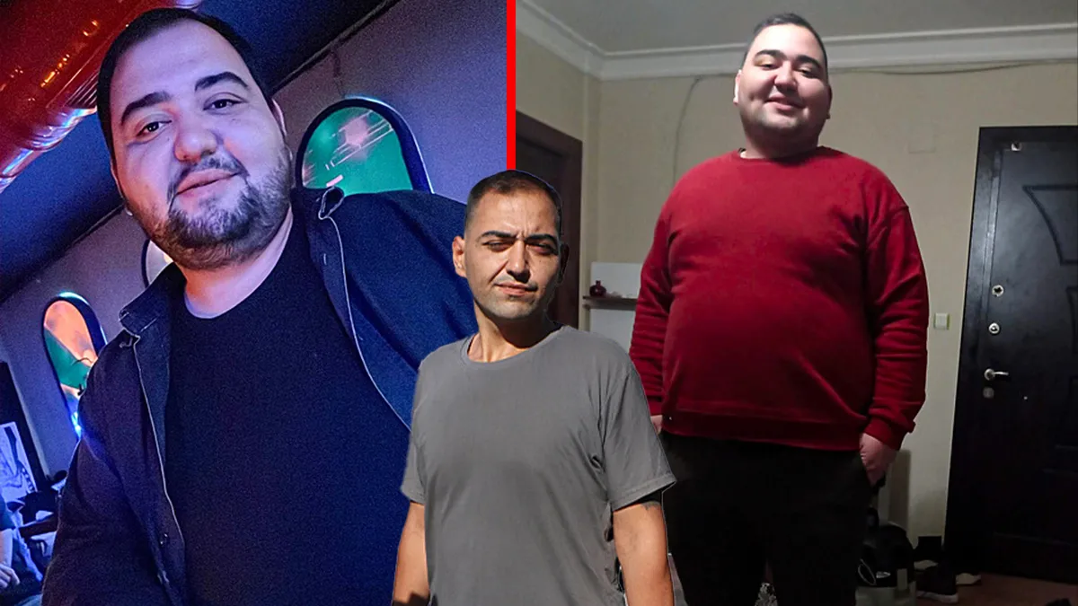 Zayıflama uğruna hayatı karardı! Defalarca bıçak altına yattı