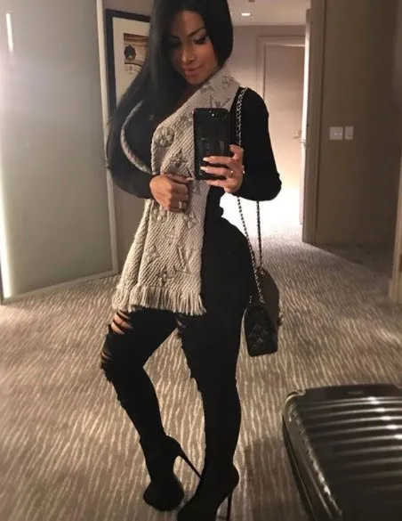 Nadinne Bruna, güzelleşmek isterken kör oldu!