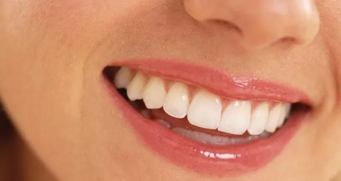 Bu 6 doğal çözüm ile diş plaklarından kurtulun!