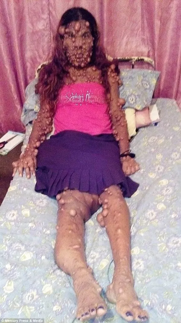 Hastalığı yüzünden tanınmaz hale geldi!