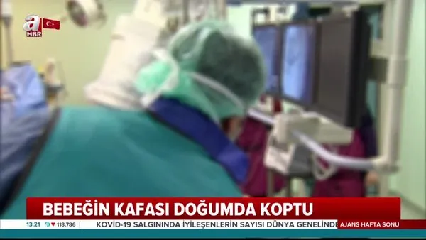 Ankara'daki doğumda korkunç son! Bebeğin kafası doğumda koptu | Video