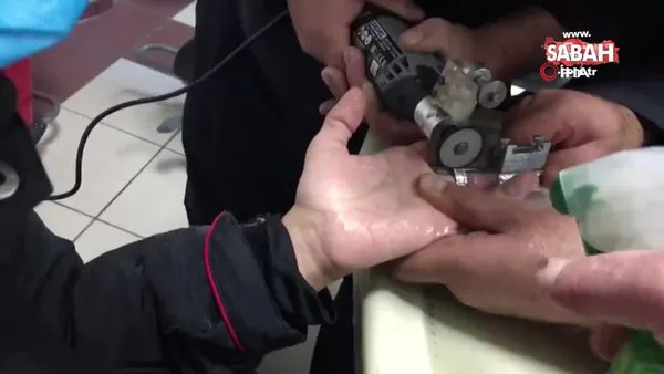 Kayseri'de itfaiyenin parmağı kangren olmaktan kurtaran yüzük operasyonu kamerada | Video