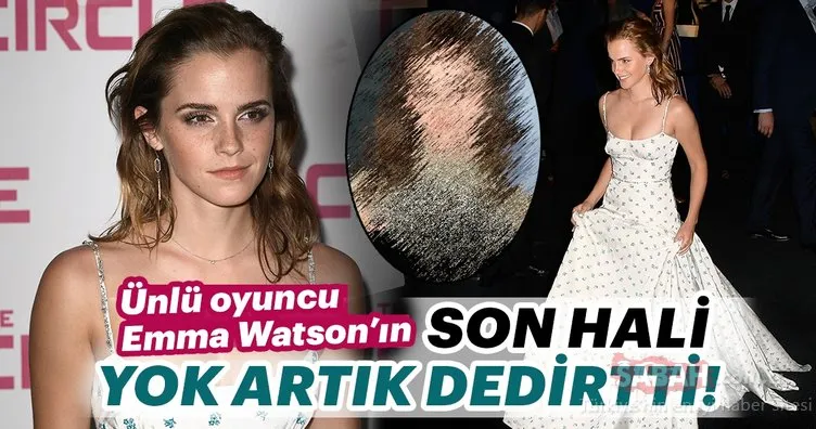 Ünlü oyuncu  Emma Watson’ın son hali yok artık dedirtti!