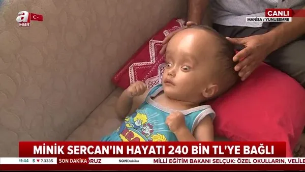 Manisa'da yürek burkan görüntü! 2 yaşındaki Sercan hidransefali hastası... Yaşamak için 240 bin TL'ye ihtiyacı var | Video