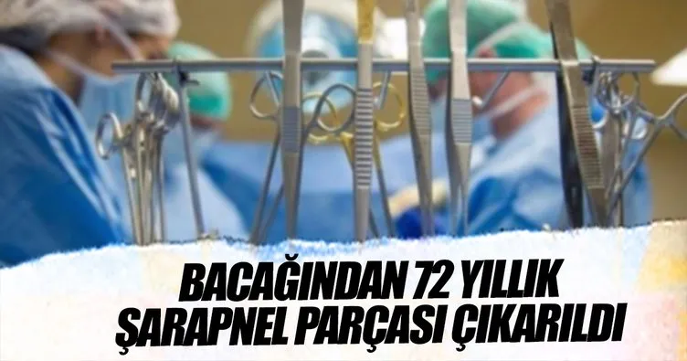 Çinli kadının bacağından 72 yıllık şarapnel parçası çıkarıldı