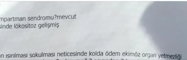 kopek-isirdiktan-sonra-olmustu-bilim-kurulu-uyesi-o-bakteriye-isaret-etti-1712239050561.jpg