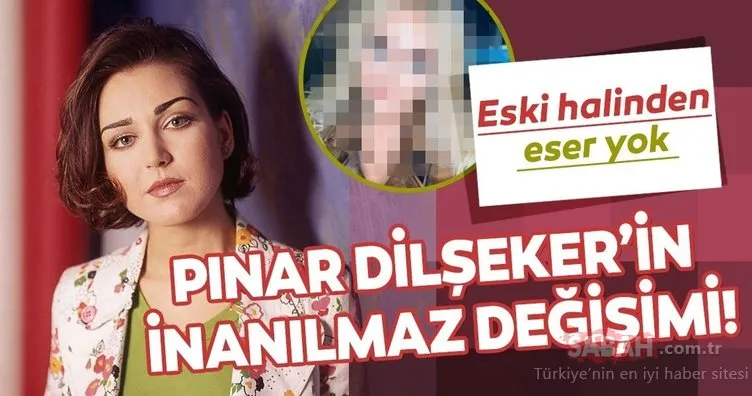 Pınar Dilşeker estetiğin dozunu kaçırınca… Bu haliyle tanımak imkansız