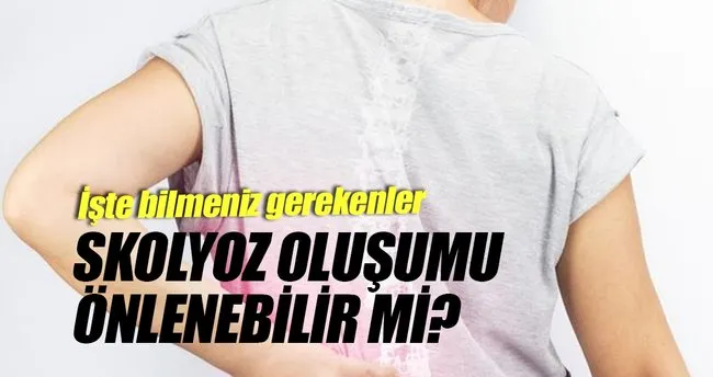 Skolyoz Egzersiz Yapmaniza Engel Degil Saglik Haberleri