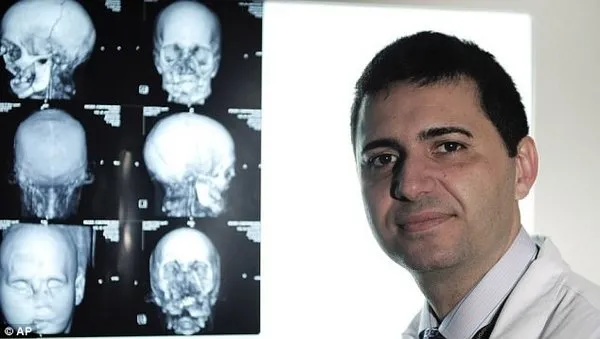 Dünyanın ilk yüz nakli...