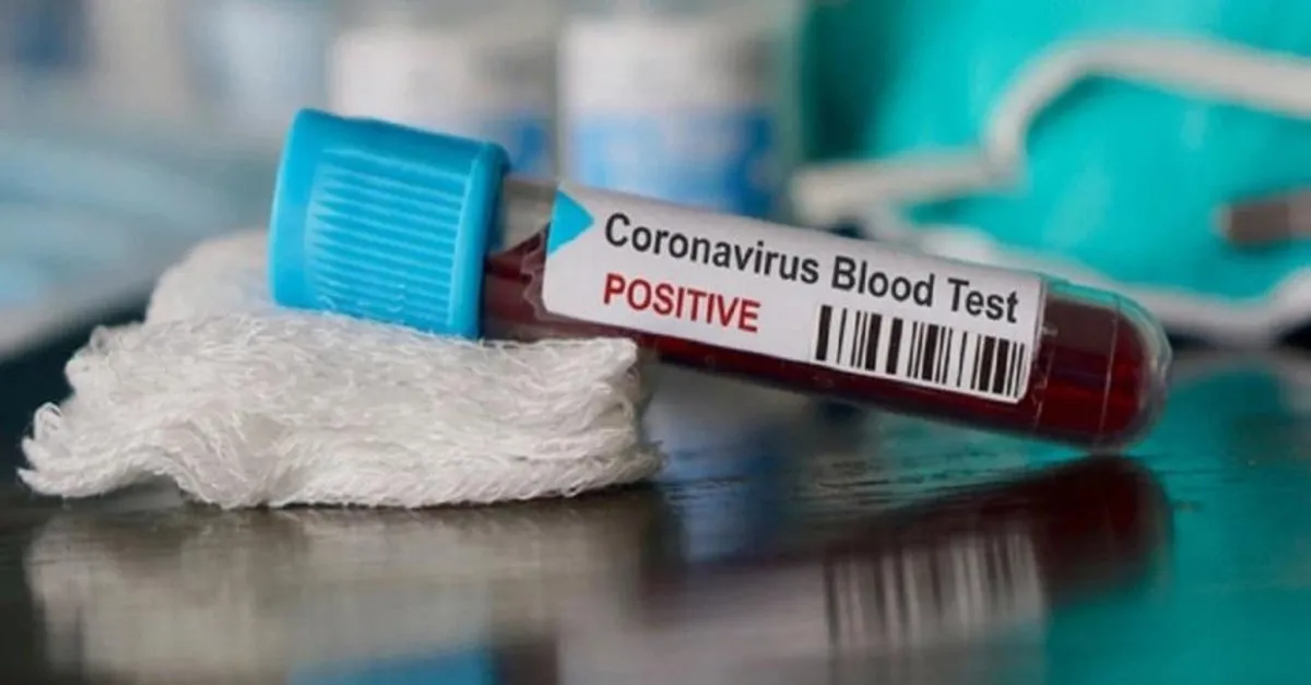 pilot il belli oldu turkiye de