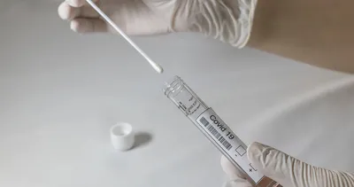 Akıllı telefonla coronavirüs testi yapılabilecek! PCR testi kadar doğru sonuç veriyor