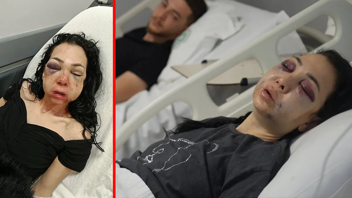 İzmit’teki kafede oğluyla birlikte öldüresiye darp edilmişti! Saldırganlar hakim karşısında: ‘Yüzündeki kemikleri kırıp…’ İzmit’teki kafede oğluyla birlikte öldüresiye darp edilmişti! Saldırganlar hakim karşısında: ‘Yüzündeki kemikleri kırıp…’