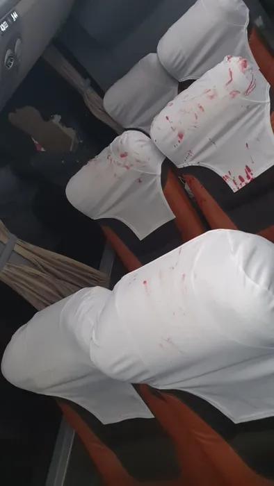 Son dakika: Brezilya’da takım otobüsüne bombalı saldırı! Kan donduran görüntüler ve Trabzonspor detayı...