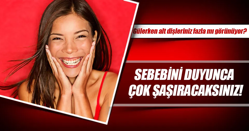 Gülerken alt dişleriniz fazla mı görünüyor? Sağlık Haberleri