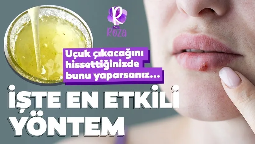 Uzman isim açıkladı! Uçuğa karşı neler yapmalıyız? 14 Uzman isim açıkladı! Uçuğa karşı neler yapmalıyız?