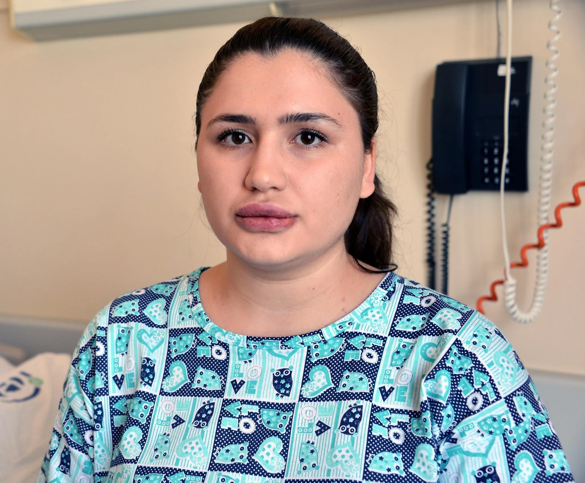 Silikon mağduru hemşirenin son hali FotoHaber Yaşam