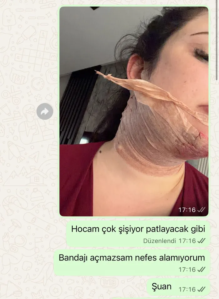 estetik-ameliyati-sonrasi-yogun-bakimda-2-gun-tedavi-gordu-doktor-hakkinda-sikayetci-oldu-1788597932171.jpg