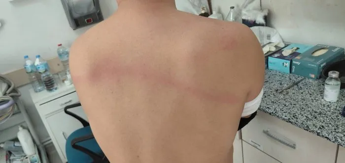 Dayakçı Başkanın dosyası kabarık çıktı: Zabıtayı sopayla döven Başkan ile ilgili iddiaların ardı arkası kesilmiyor!