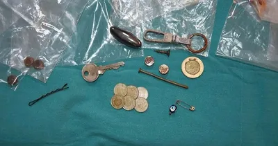 Çocukların yuttuğu cisimler şaşkına çevirdi