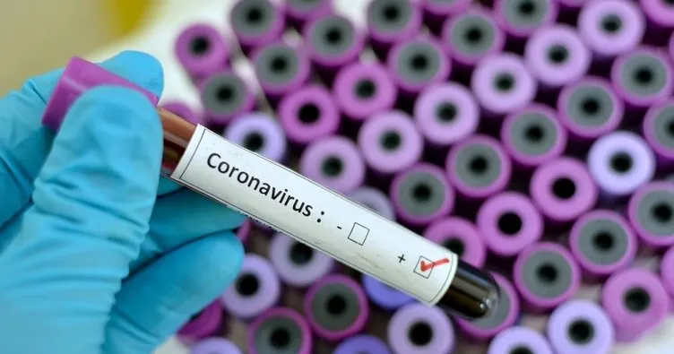 Koronavirüs test sonucu kaç günde ve ne zaman çıkar? Covid 19 test sonucu E nabız ile sorgulama ekranı!