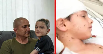 Sokak köpekleri tarafından saldırıya uğramıştı! Tunahan Yılmaz davasında flaş gelişme