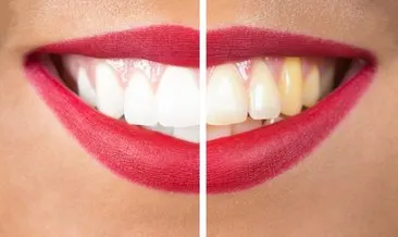 Uzmanların önerisi! İşte inci gibi beyaz dişler veren 4 yöntem