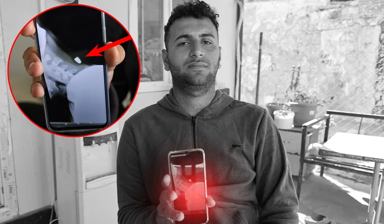 Yorgun mermi molada yakaladı: Şah damarına tam 2 santim!