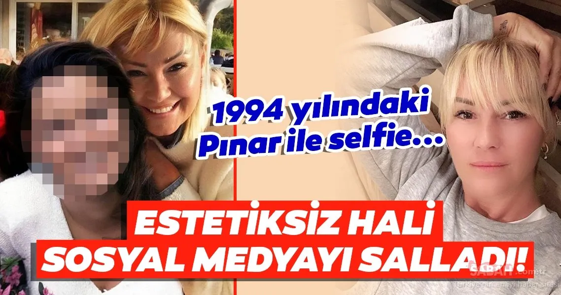 Pınar Altuğ estetiksiz hali ile selfie yaptı sosyal medya yıkıldı! İşte