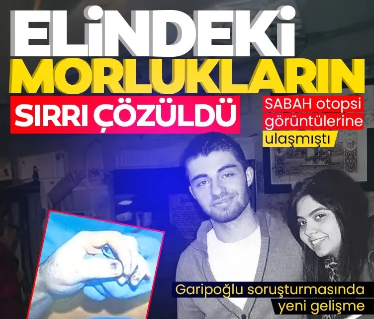 Cem Garipoğlu’nun otopsi fotoğraflarında görülmüştü: Ellerindeki mor lekelerin sırrı ne?