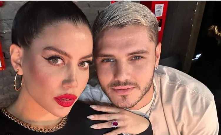 Wanda Nara’nın estetiksiz hali olay oldu! Resmen evrim geçirmiş