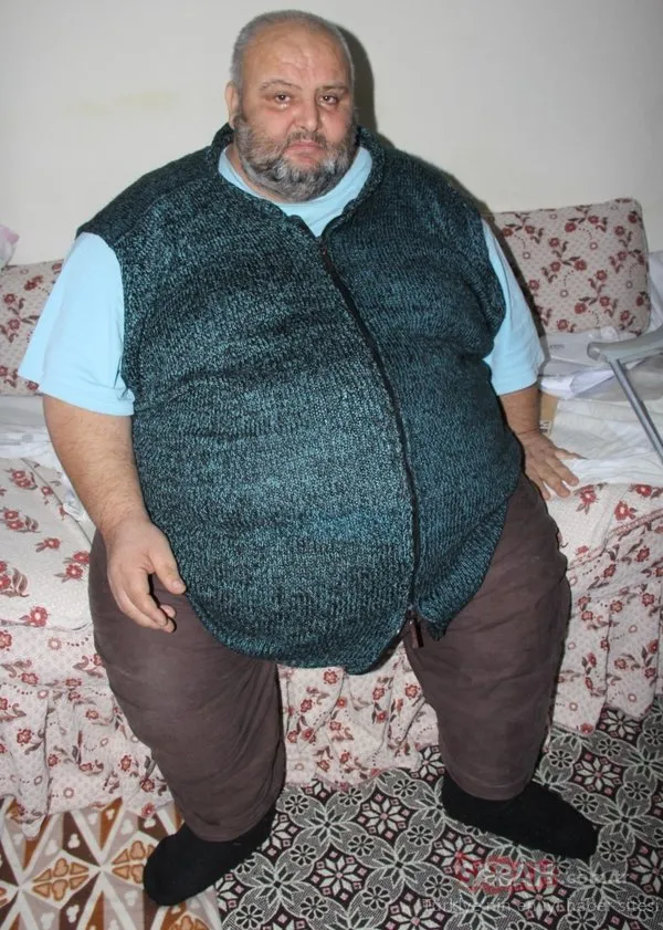 Değişimi inanılmaz oldu! 152 kilo verdi ayağa kalkar kalmaz yaptığı ilk iş bakın ne oldu!