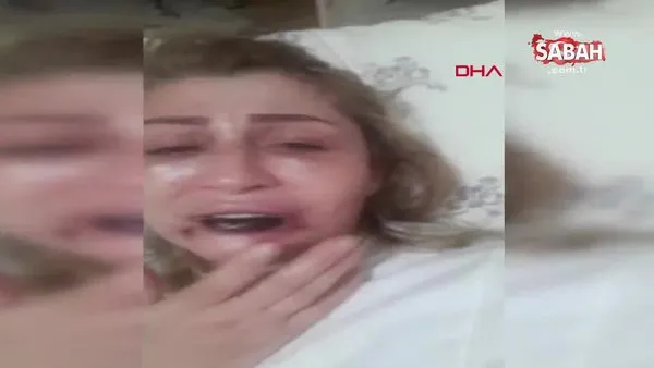 Antalya'da güzelleşmek için operasyon yaptıran kadının yüzünde çürüme başlayınca dudağı düştü!