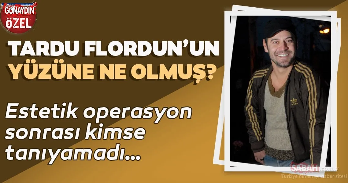 Tardu Flordun’u estetik operasyon sonrası kimse tanıyamadı! Senin