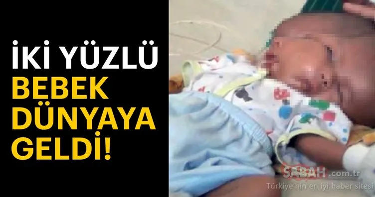 Endonezya’da iki yüzlü bebek dünyaya geldi!
