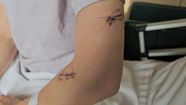 22 yerinden bıçaklanan Mucize Kadın konuştu: Önce otele gitmeyi teklif etti sonra…