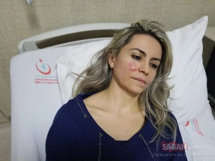 Şanlıurfa’da kadın doktoru darp eden saldırgan yakalandı