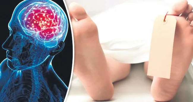 Kalpleri durduktan 1 saat sonra bilinç açık çıktı