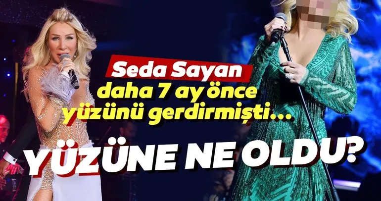 Seda Sayan’ın yüzüne ne oldu? Ünlü şarkıcı Seda Sayan daha 7 ay önce yüzünü gerdirmişti...