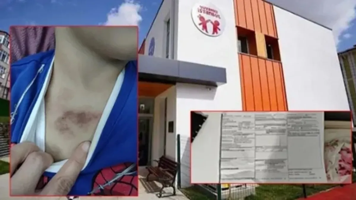 İBB’ye bağlı kreşte darp ve cinsel istismar skandalı! Ekipler inceleme yaptı İBB’ye bağlı kreşte darp ve cinsel istismar skandalı! Ekipler inceleme yaptı