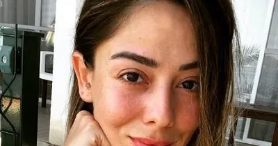 Ünlü isimlerin makyajsız halleri Merve Sevi