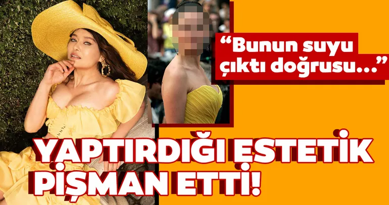 Nurgül Yeşilçay’ı yaptırdığı estetik pişman etti! Nurgül Yeşilçay Bunun suyu çıktı doğrusu...