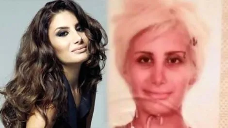 Unlulerin Estetiksiz Hali 2017 Galeri Magazin