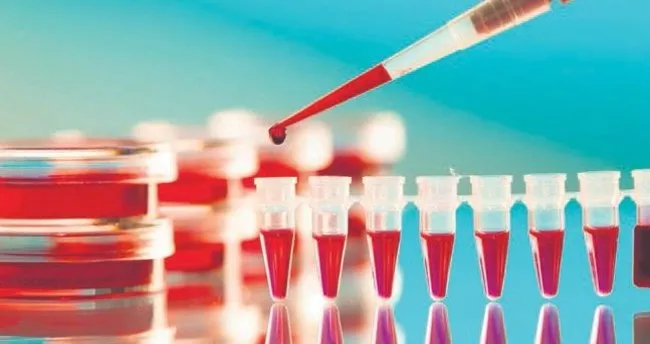 hiv in tedavisi mumkun zor olan hastaya