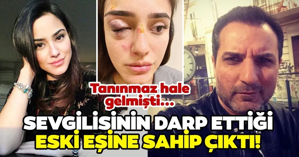 Bebeğinin babası tarafından öldüresiye dövülen Ceren Bebeğinin babası tarafından öldüresiye dövülen Ceren
