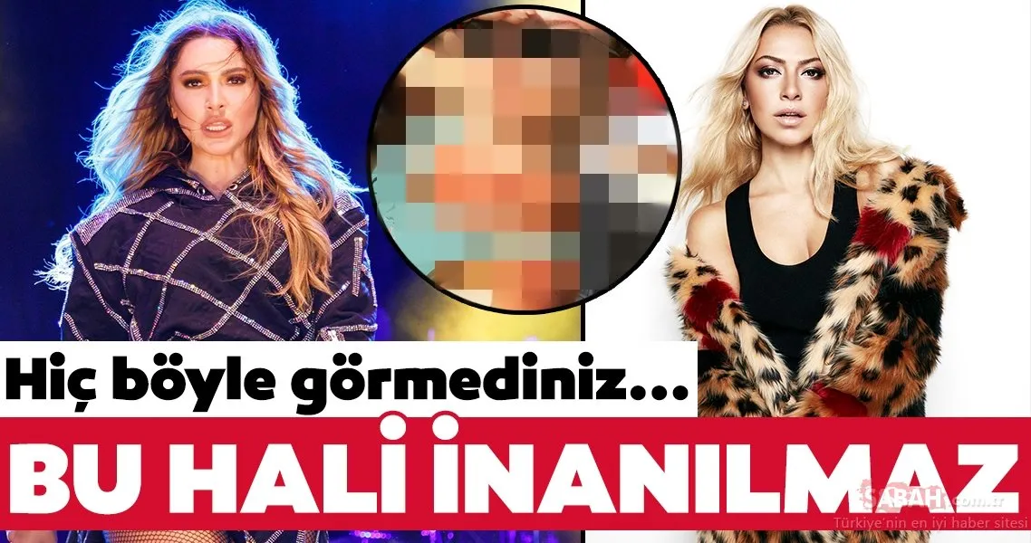Hadise�nin bu hali şoke etti! Hadise�yi hiç böyle görmediniz