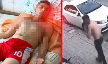 Gaziosmanpaşa'da akılalmaz vahşet! Duyma engelli Ahmet'i önce gasbetti sonra benzinle ateşe verdi! #istanbul