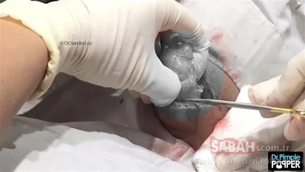 Doktora bu halde geldi! Sonrasındaysa...