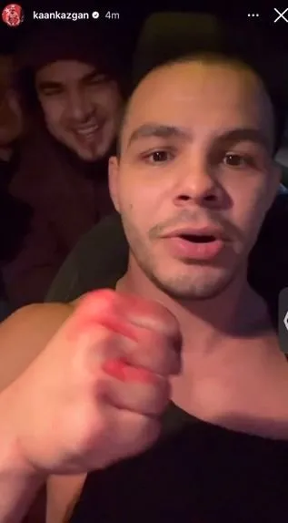 Savaş Cebeci Kaan Kazgan kavgası kanlı bitti: 70 kilo kimse beni dövemez demişti!